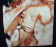 Dr_Luis_Chacon_4D_Ultrasound_CMQ